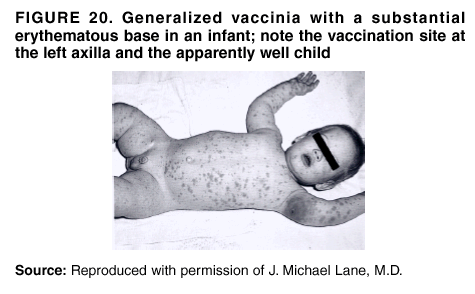 Smallpox Vaccination and Adverse Reactions